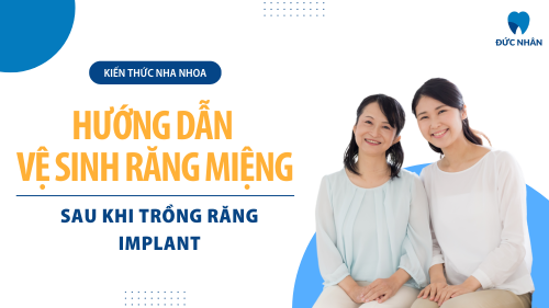 Hướng dẫn cách vệ sinh răng miệng sau khi trồng răng Implant chuẩn